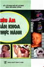 Siêu âm Sản khoa Thực hành – BV Hùng Vương