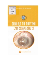 Bệnh đục thể thủy tinh chẩn đoán và điều trị