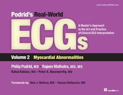 Podrid's Real-World ECGs Volume 2, Myocardial Abnormalities