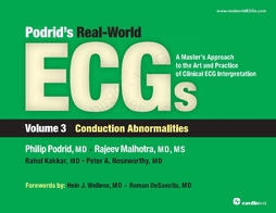 Podrid's Real-World ECGs Volume 3, Conduction Abnormalities