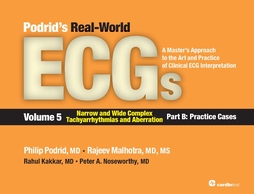 Podrid's Real-World ECGs, Volume 5B Narrow and Wide Complex Tachyarrhythmias and Aberration. Part 5B Practice Cases